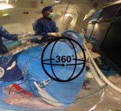 360 degree photo of a chronic total occlusion, CTO, case at Henry Ford Hospital in Detroit.