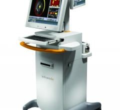 Infraredx Inc. TVC Imaging System Intravascular Ultrasound IVUS Clinical Study