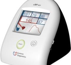 SunTech Centron Diagnostics Central Blood Pressure Technology