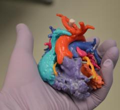 3-D modeling, reconstructed hearts, child heart transplants, AHA Scientific Sessions 2015