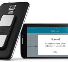 AliveCor, AliveECG app, ECG recording, remote wireless, mobile, patient