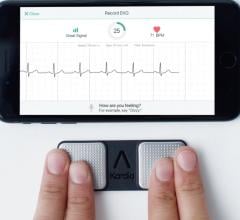 Alivecor's pocket ECG system allows consumers or cardiologists to record a single lead ECG. AI algorithms can determine if their ECG is normal or abnormal and identify the arrhythmia. 