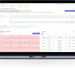 Based on pioneering research from Mayo Clinic, ECG-AI LEF aims to aid physicians in identifying low ejection fraction in patients at risk of heart failure 