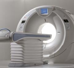 New York Hospital Finds Significant Cost Savings With Toshiba's Aquilion One CT