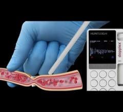 Technological innovations have now enabled the development of a new intraoperative Doppler system that includes a single-use, sterile intraoperative probe and Dopplex DMX Vascular Doppler. 