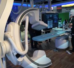 Philips Launches Azurion With FlexArm