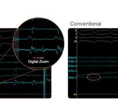 AI for Atrial Fibrillation. BioSig Technologies Inc., a medical technology company commercializing an innovative biomedical signal processing platform designed to improve signal fidelity and uncover the full range of ECG and intra-cardiac signals, today announced that the company entered into a feasibility study with The Technion Research & Development Foundation Ltd.