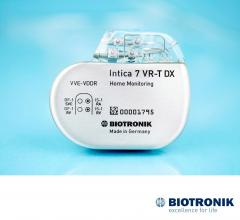 What is an Implantable Cardioverter Defibrillator ICD? | DAIC