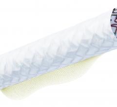 FDA Approves Biotronik's PK Papyrus Stent for Coronary Perforations