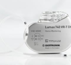 Lumax 740 DX system, ICD