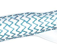 FDA Clears Boston Scientific Synergy Megatron Drug-eluting Stent for Proximal, Fibrotic and Calcified Lesions