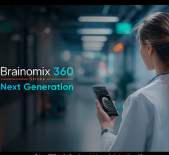 Brainomix Launches Next Generation Stroke AI Platform with Novel Net Water Uptake Technology