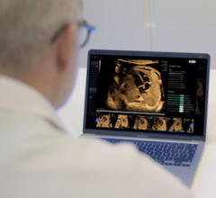 CE Mark Granted to BrightHeart's Prenatal AI Platform