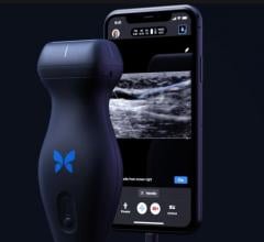 Butterfly Network Inc. is launching its next-generation Butterfly iQ+ point-of-care-ultrasound (POCUS) technology that can turn a smartphone into a diagnostic imaging system. It offers a new needle guidance app.