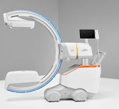 The new mobile C-arm automates repositioning during surgery