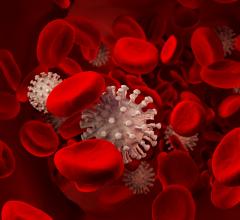 The NIH is heading three studies looking at various blood thinners and anticoagulants to treat COVID-19 patients with VTE.