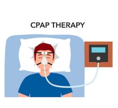 apnea, Sinai, CPAP, sleep disorder
