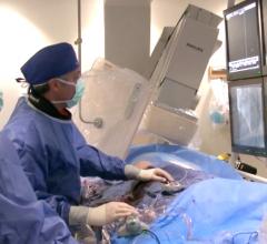 Khaldoon Alaswad, M.D., clearing a chronic total occlusion (CTO) in the cath lab at Henry Ford Hospital.