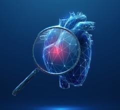 Researchers Develop Clinical Tool to Help Diagnose Pulmonary Hypertension