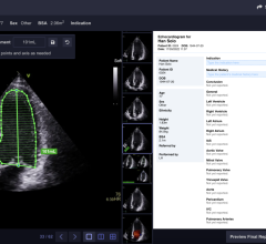 Pulse is a cloud platform for cardiac imaging that streamlines reporting workflows to help cardiologists be more efficient 