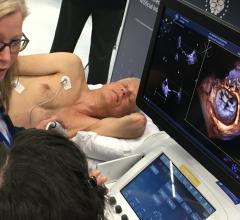FDA Issues Final Guidance on Marketing Clearance of Diagnostic Ultrasound Systems and Transducers