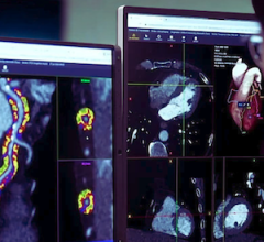 New Data Validates FAI-Score Biomarker, Highlights Potential Non-Contrast Cardiac CT Opportunity