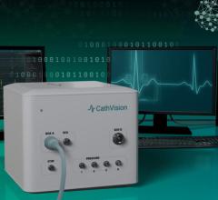 The CathVision's novel EP recording technology and amplifier ECGenius used artificial intelligence (AI) confirms if pulmonary vein isolation (PVI) is complete to reduce need for repeat EP ablations procedures.