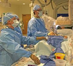 A MitraClip case underway at the University of Colorado Hospital hybrid cath lab. Left to right are doctors John Carroll, Edward Gill and Dominik Wiktor. 