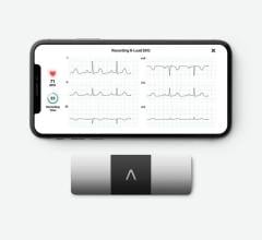 Clario and AliveCor provide a new trial participant-friendly solution for cutting-edge, at-home data collection with privacy protection, instrumental in situations where traditional 12-lead ECG cannot be collected. 