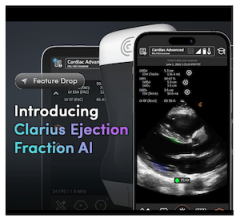 FDA Clears Clarius Ejection Fraction AI to Deliver Objective, Real-Time Cardiac Ultrasound Assessments