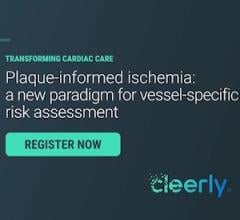 ischemia, plaque, ai