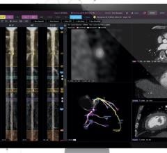 The Clear AI software can help with identification coronary plaque features in CT scans that may cause heart attacks. Cleerly Coronary’s noninvasive, AI-driven approach supports the understanding of plaques using FDA-cleared technologies.