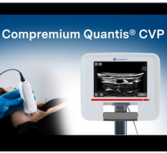 FDA Breakthrough Device Designation Granted for Non-Invasive Central Venous Pressure Measurement System