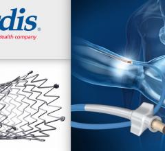 Cardinal Health Sells its Cordis Cardiology Business to Hellman & Friedman. Hopes to build the Cordis Accelerator for innovative cardiovascular device development.