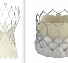 Medtronic is starting a randomized, head-to-head study comparing the Medtronic CoreValve Evolut Pro and Pro+TAVR Systems against the balloon-expandable Edwards Sapien 3 and Sapien 3 Ultra Transcatheter Heart Valvestwo transcatheter aortic valve replacement (TAVR) systems in patients with severe symptomatic aortic stenosis (ssAS). 
