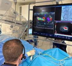 Corify Care to Introduce First Whole-Heart Mapping Technology