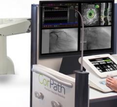 Corindus Evaluates Incorporating HeartFlow Technology With CorPath GRX System