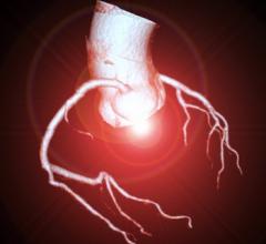 Expert: Faster and Cost-effective CCTA Testing Helps Save Lives