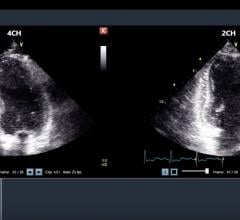 Konica Minolta Healthcare Partners With DiA Imaging Analysis for AI-based Cardiac Ultrasound Analysis