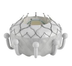 The EVOQUE system is indicated for the improvement of health status in patients with symptomatic severe TR despite optimal medical therapy (OMT), for whom tricuspid valve replacement is deemed appropriate by a heart team.