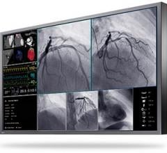 Eizo Presents New Large-Format 4K UHD Monitor for Interventional Radiology and Endoscopy