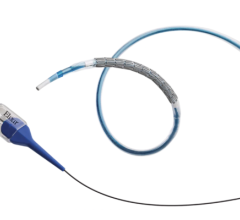 DESyne BDS Plus system with site-specific antithrombotic therapeutic (TRx) significantly reduced the risk of TLF versus conventional drug-eluting stent through 12-months