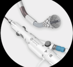 Thrombectomy System, Blood Return System Get FDA Approval