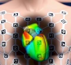FDA, cardiac mapping, ep lab