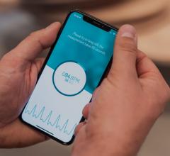 More than 60,000 from the general population in Belgium were screened for AFib using only a smartphone app in the DIGITAL-AF II study. The study used the FibriCheck app found 791 participants has measurements indicative for AF.