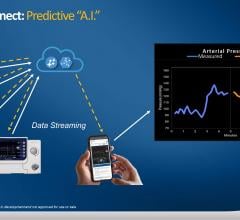 The Abiomed Impella Connect allows data streaming from the Impella control consoles to the cloud, where the next step will be to apply predictive artificial intelligence (AI) algorithms.