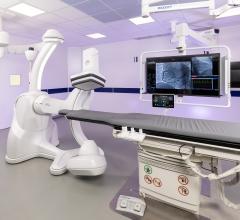 Building on the award-winning Allia platform for image guided therapies, GE HealthCare's new Allia IGS Pulse was designed to improve workflow for the diagnosis and treatment of cardiovascular diseases in interventional cardiology. (Photo: Business Wire) 
