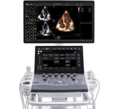 GE HealthCare Debuts Next Generation of Vivid Cardiovascular Ultrasound Portfolio