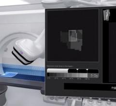GE Healthcare DoseMap Radiation Dose Management Angiography Systems