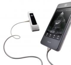 LVivo EF Cardiac Tool Now Available for GE Vscan Extend Handheld Mobile Ultrasound